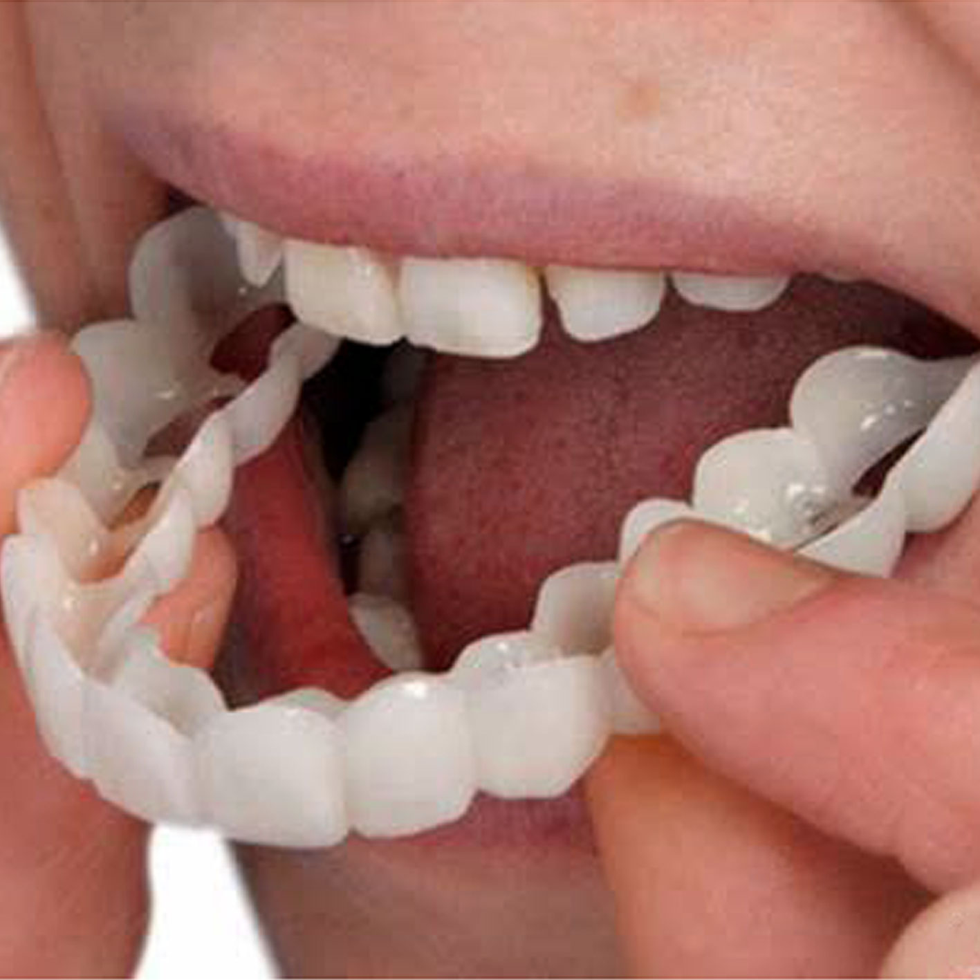 پروتز متحرک